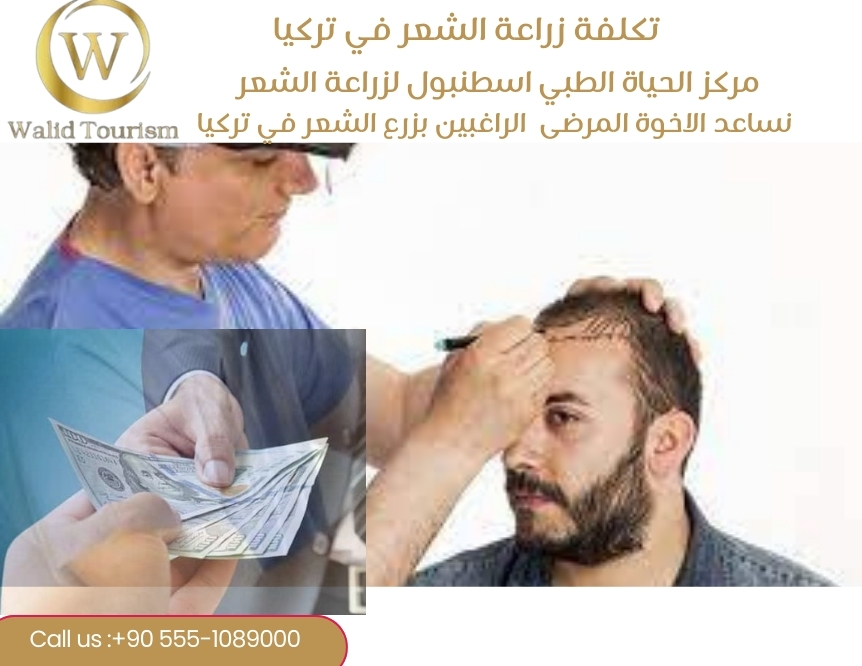 تكلفة زراعة الشعر في تركيا